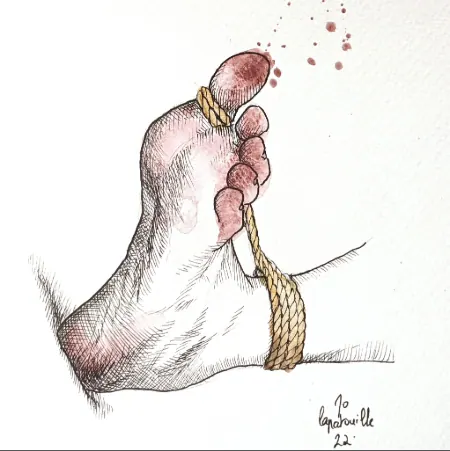 A watercolor style illustration of a foot with toe tied to ankle.