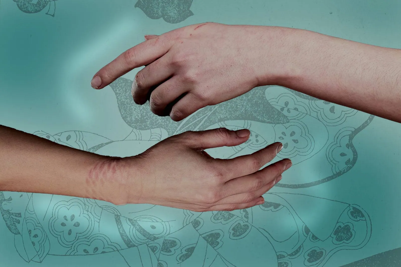 Two hands against a green graphic background, one with rope marks